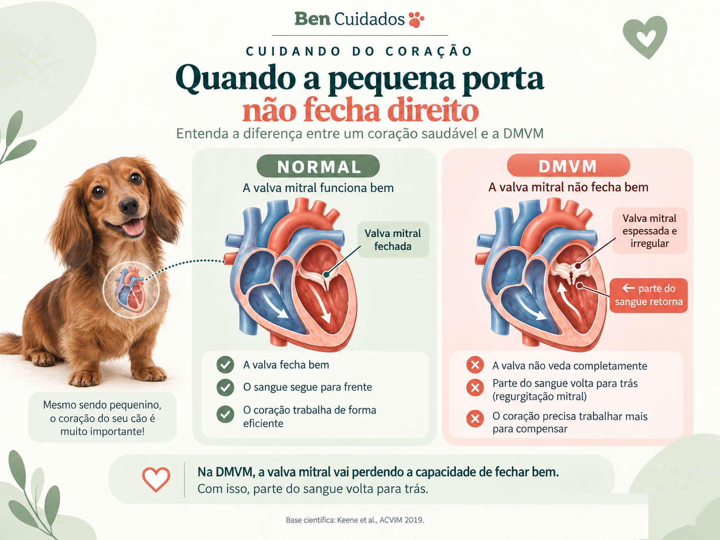 Infográfico: comparação entre um coração normal, com a valva mitral fechada, e um coração com DMVM, em que parte do sangue retorna