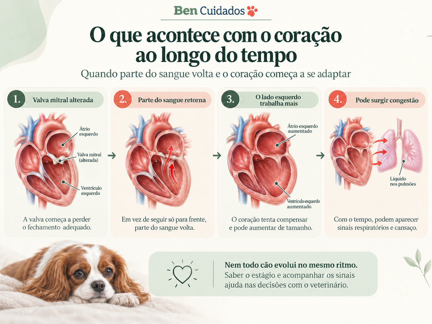 Infográfico em quatro etapas: valva mitral alterada, parte do sangue retorna, o lado esquerdo trabalha mais e aumenta, e pode surgir congestão com líquido nos pulmões